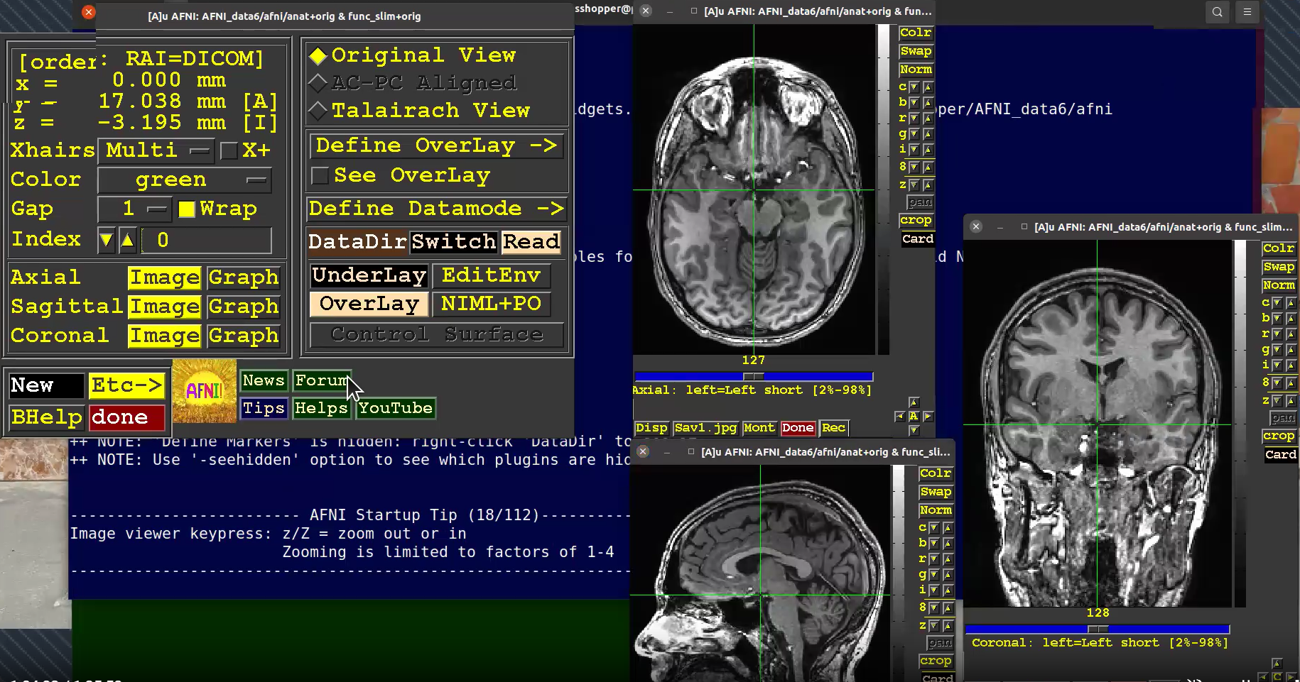 Analysis of Functional NeuroImages