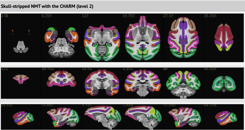 Skull-stripped NMT with the CHARM (level 2)